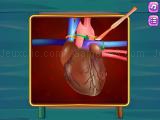 Play Heart transplant surgery now