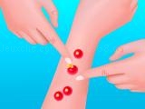 玩 Pimple poper rush now